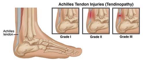 treatment for foot and ankle pain