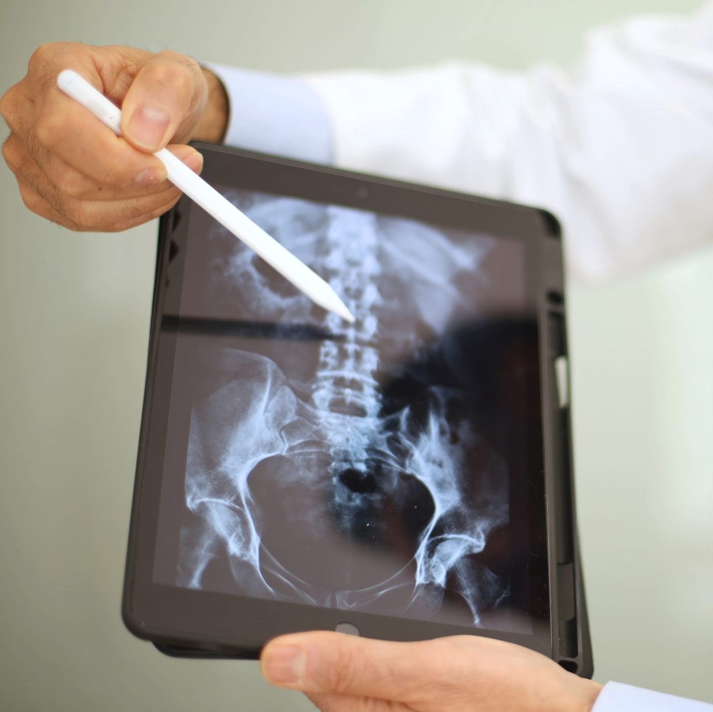 Doctor holding x-ray at Carolina Chiropractic Plus
